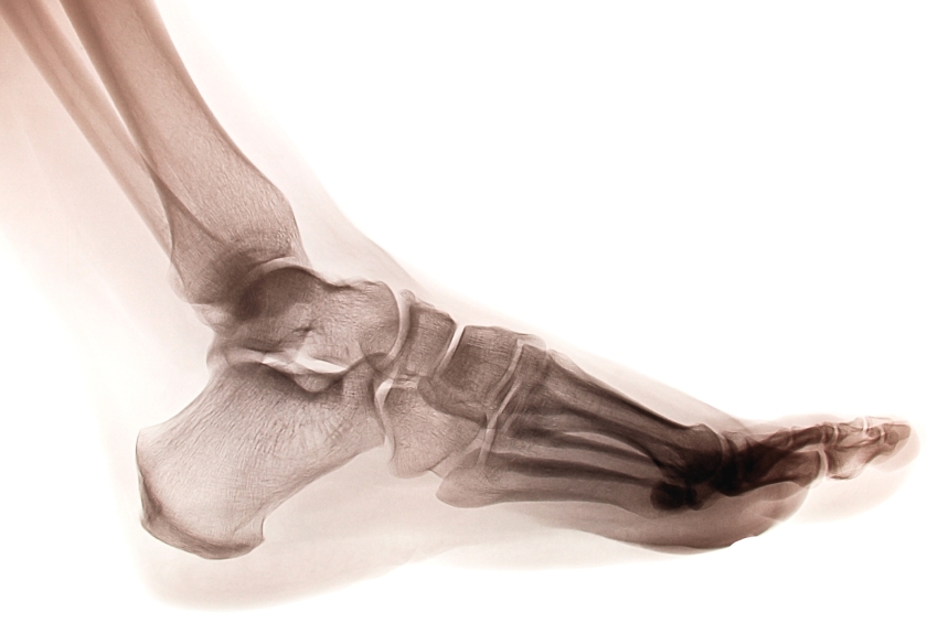 17 Common Causes of Foot Pain and Discomfort